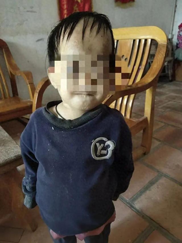 广东一女童被遗弃在道观多年！身患多种疾病且无户口当地回应：多部门正联合处理(图1)